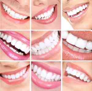Benefits of Cosmetic Dental Smile